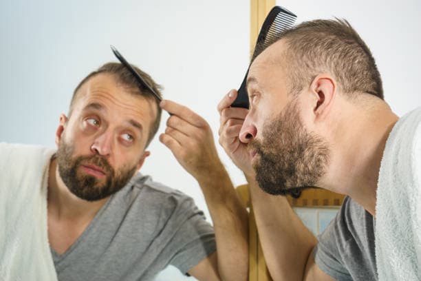 How Much Does Hair Transplant Cost for 3000 Grafts?
