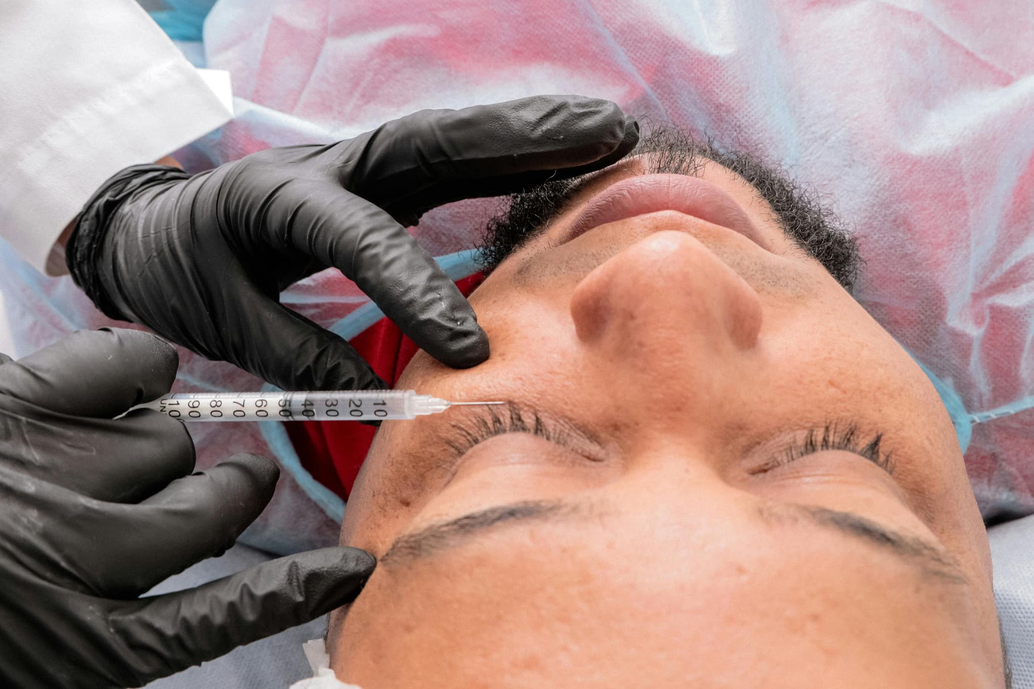 Botox Nyack: How Vim Wellness FNP Personalizes Your Treatment for Natural Expression
